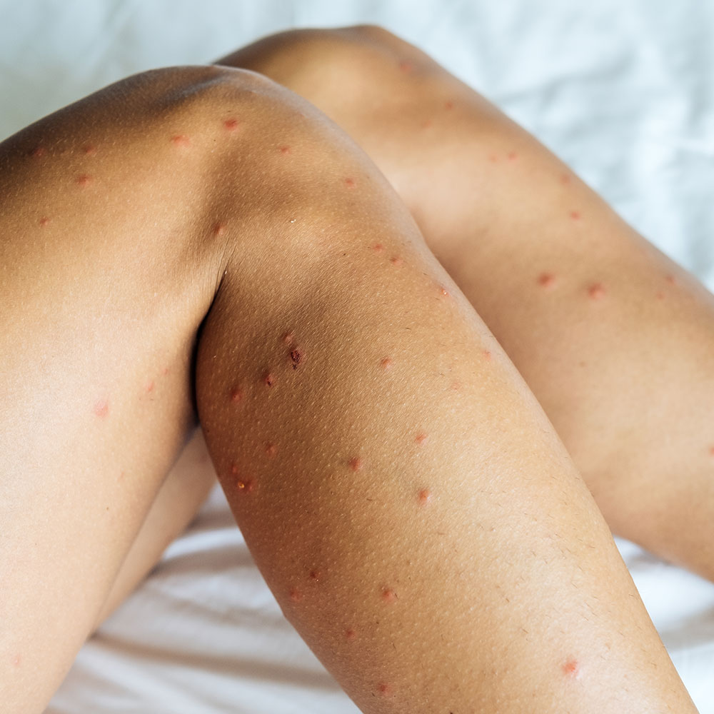 Bed Bug Control Whangarei & Northland